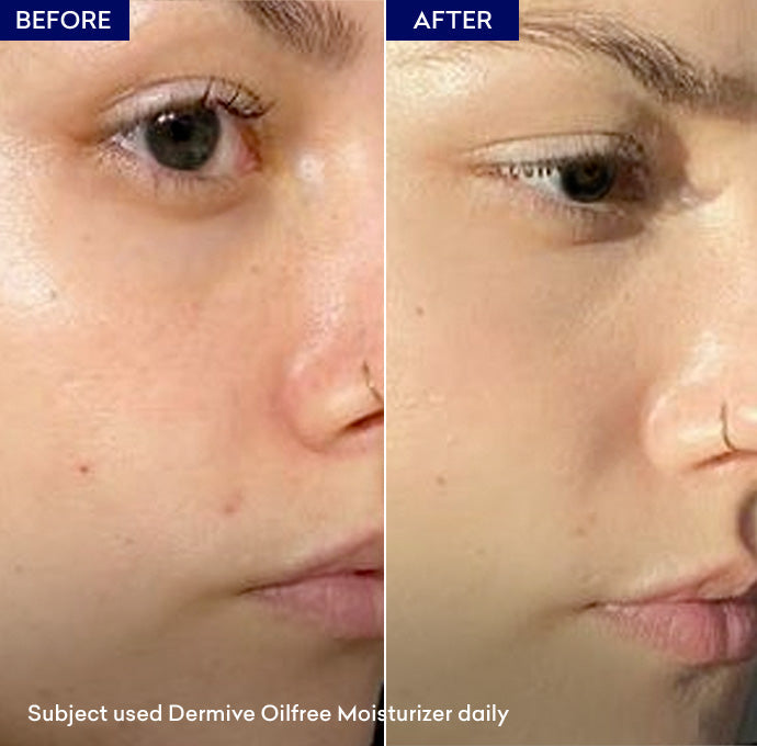 Jenpharm - Dermive Oil Free Moisturizer Lotion 100ml